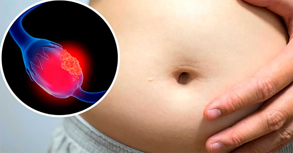 Westchester ofrece pruebas de detección de cáncer