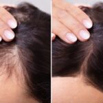 Por qué se electriza tu cabello