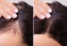 Por qué se electriza tu cabello