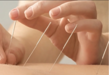 Asamblea de Nueva York aprueba cobertura obligatoria de acupuntura